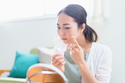 ピコレーザーでシミが消えない原因は？対処法や術後の注意点について解説のアイキャッチ画像