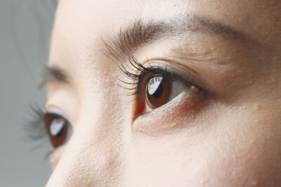目の下のたるみの原因は？セルフケア方法・治療方法について解説のアイキャッチ画像