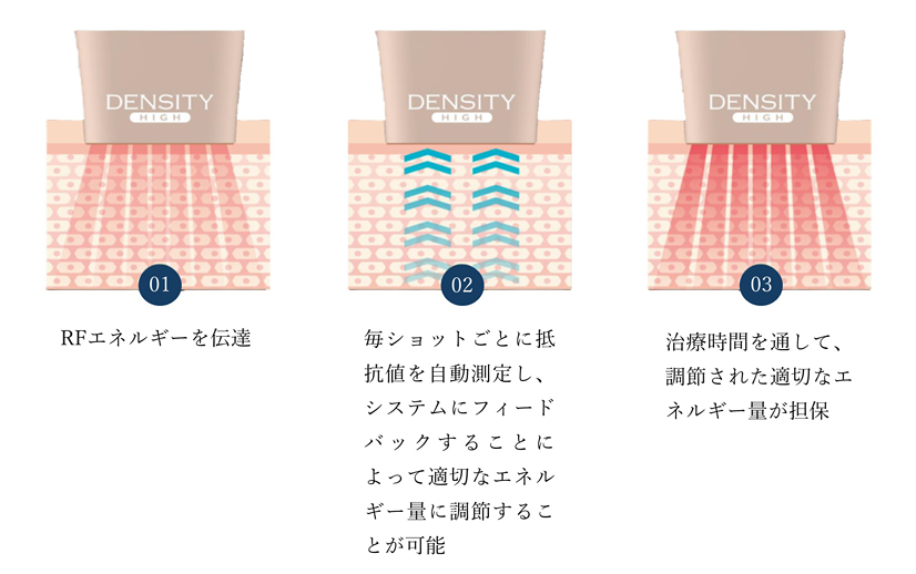 モノバイRF